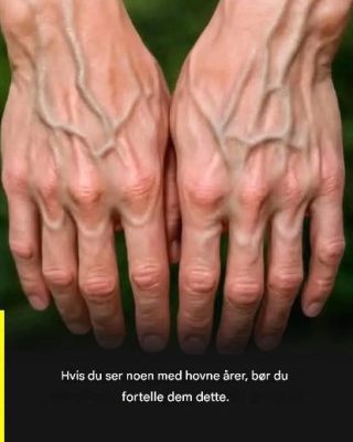 Hvis årene dine er synlige, betyr det at du er…